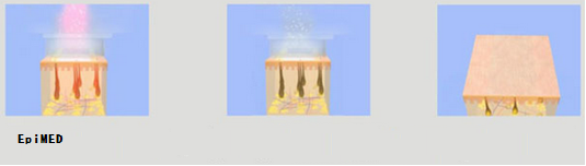 Painless IPL OPT SHR Hair Removal Machine with Xenon Lamp , 650 - 950 nm Wavelength