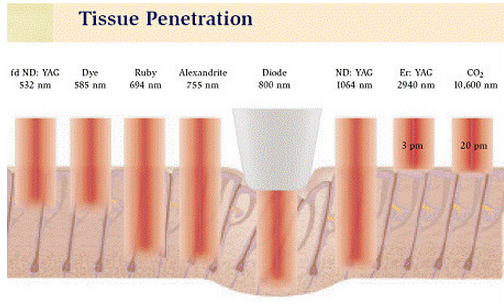 IPL Permanent Hair Reduction High Performance , Intense Pulsed Light Hair Remover