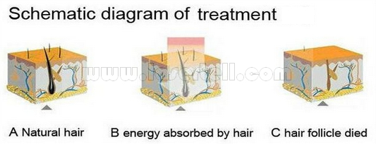 Women SHR IPL Beauty Equipment for Hair Removal Skin Rejuvenation Single Pulses