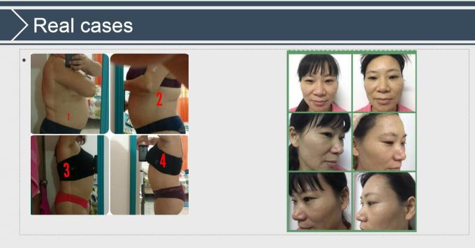Cavitation+Vacuum+RF+Laser+Roller System Slimming Beauty Equipment CE