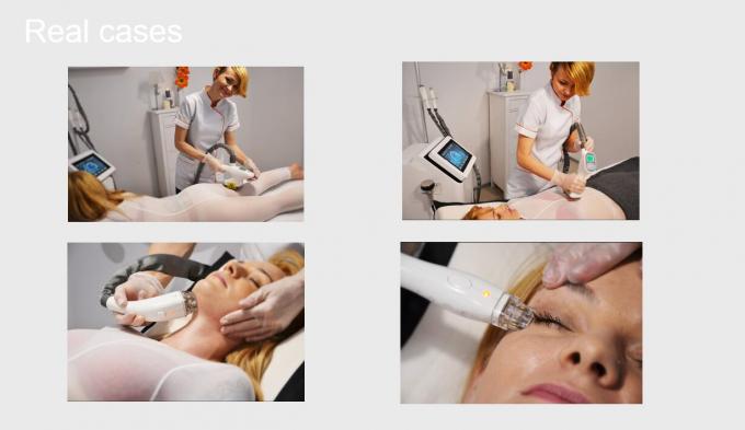 Cavitation+Vacuum+RF+Laser+Roller System Slimming Beauty Equipment CE