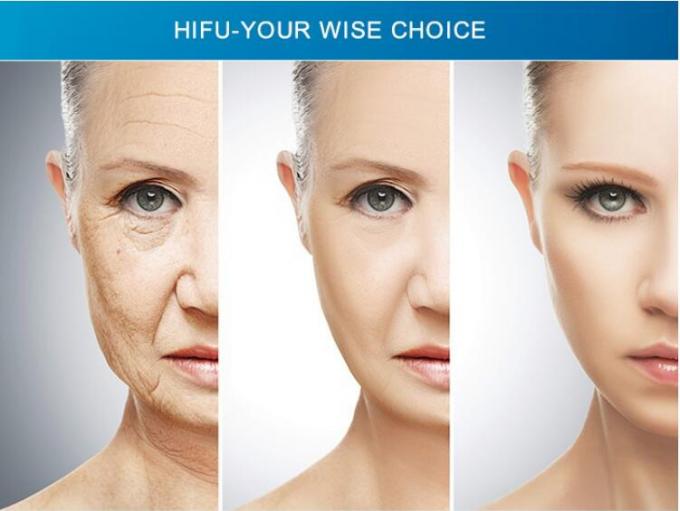 3D Anti - Aging Hifu Beauty Machine Beauty Salon Equipment For Skin Tightening