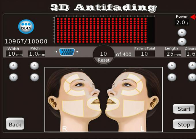 20000 Shots 3D Hifu Facelift Machine 8 Cartridges With 1-11 Lines