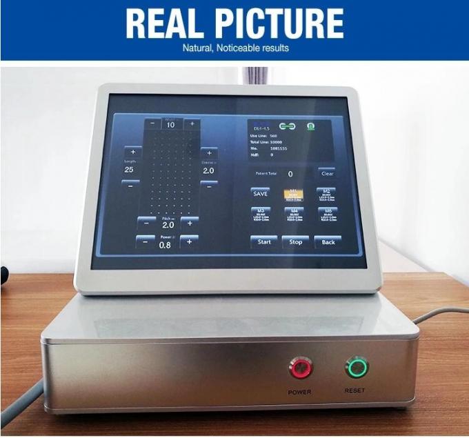 4MHz 11 Lines Portable Hifu Machine / 20000 Shots 2D Hifu Facelift Treatment