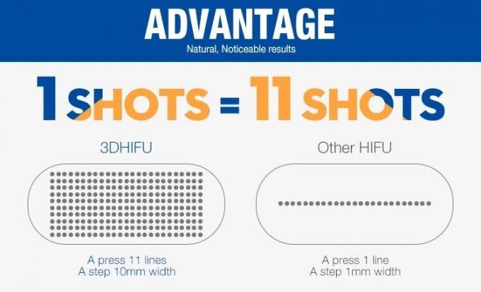 4MHz 11 Lines Portable Hifu Machine / 20000 Shots 2D Hifu Facelift Treatment