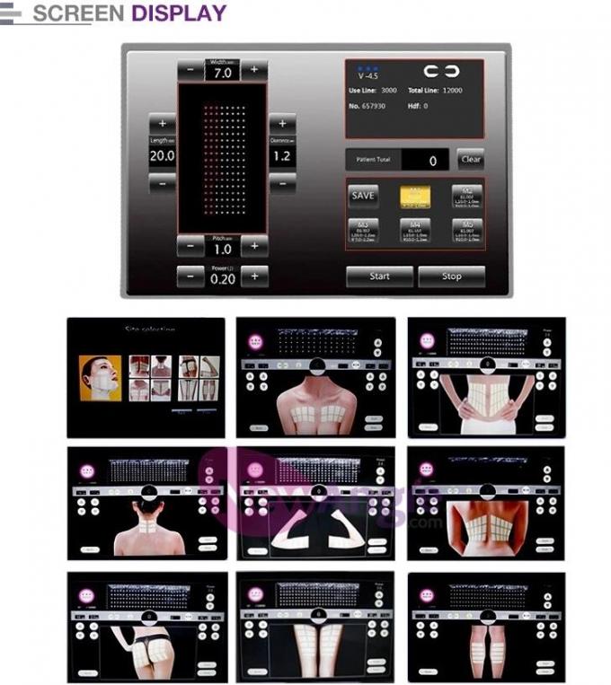 150VA Hifu Skin Tightening Machine 8 Cartridges / Hifu Slimming Machine 15 Inch Screen