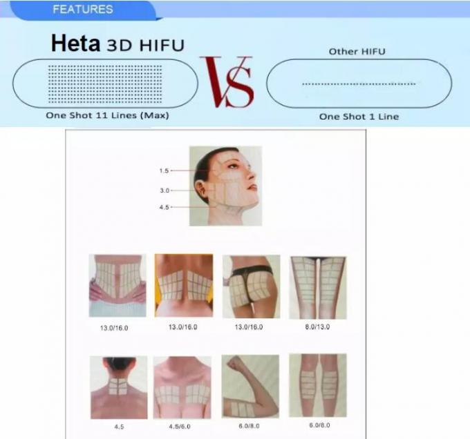 150VA Hifu Skin Tightening Machine 8 Cartridges / Hifu Slimming Machine 15 Inch Screen