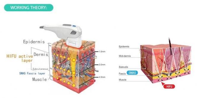 Ultrasound Portable Hifu Beauty Machine 50-60Hz Intensity Focused CE Approval