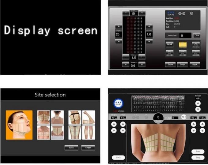Anti Wrinkle 2D Hifu Beauty Machine 44×30×38 Cm With FDA Certificate