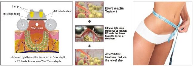 40K Cavitation Vacuum RF Slimming Machine V9 Velashape With CE Certification