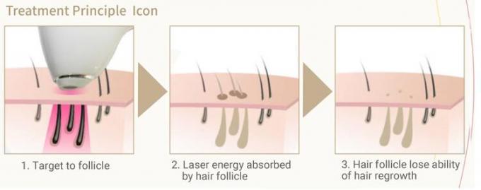 Permanent IPL Laser Machine Active TEC Cooling With Germany Laser Bars
