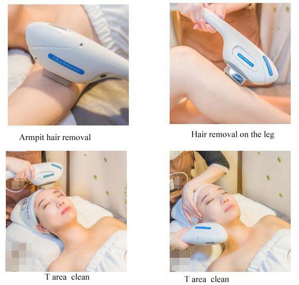 Nd Yag Laser Multifunction Beauty Machine With Intelligent Operating System
