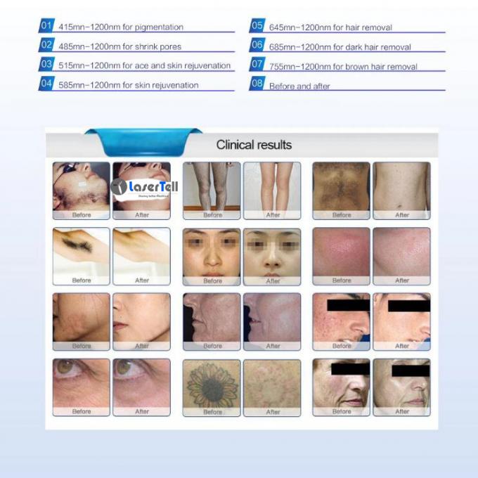 Nd Yag Laser Multifunction Beauty Machine With Intelligent Operating System